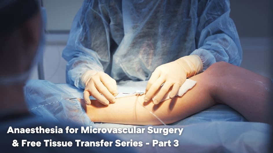 Thumbnail for Anaesthesia for Microvascular Surgery & Free Tissue Transfer - Antithrombotic & Vasoactive drugs