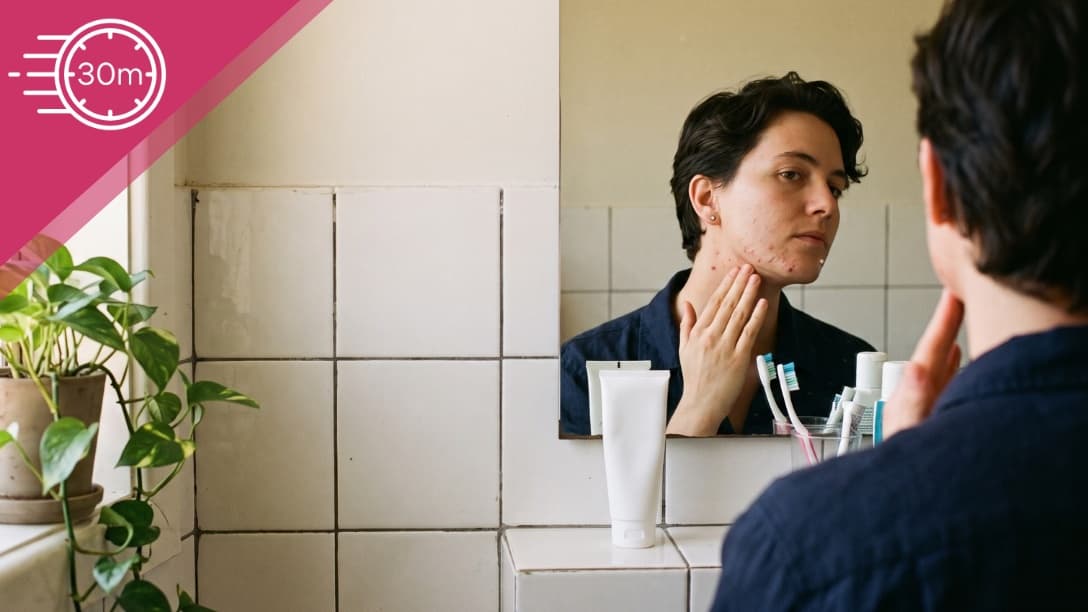 Image for Acne in Gender-Affirming Care