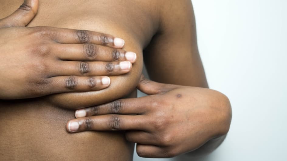 Thumbnail for Breast Cancer: Detection to Diagnosis and Beyond