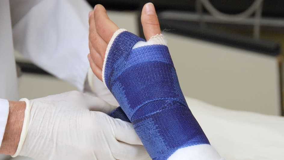 Thumbnail for Distal Radius Fractures: Acute Management and Hand Therapy Rehabilitation
