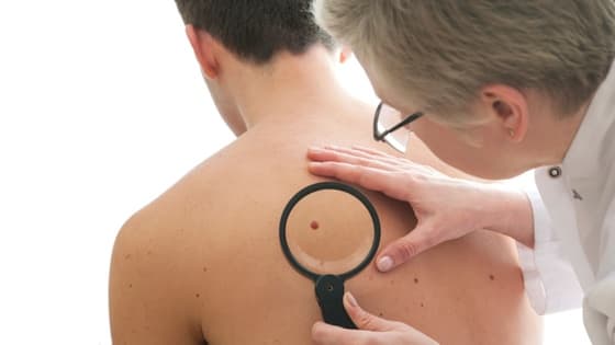 Thumbnail for Pathology-led Education - National Surgical Skin Audit