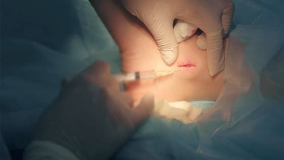 Thumbnail for Painless Local anaesthesia and local Anaesthetic Blocks for Minor Surgery