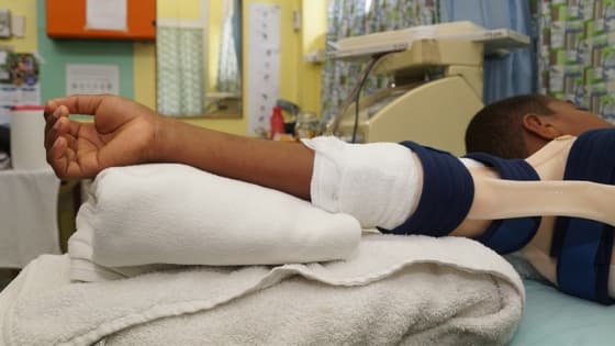 Thumbnail for Burns Rehabilitation & Axilla Management