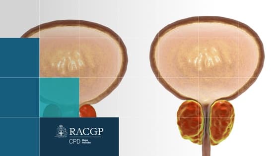 Thumbnail for Prostate and UTIs Best Practice