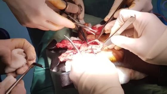 Thumbnail for The History and Development of Plastic & Reconstructive Surgery