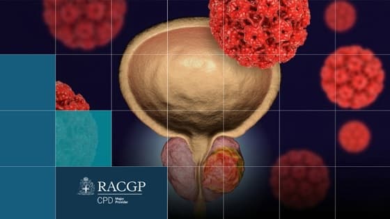 Thumbnail for Prostate Cancer and Post Surgery Rehabilitation