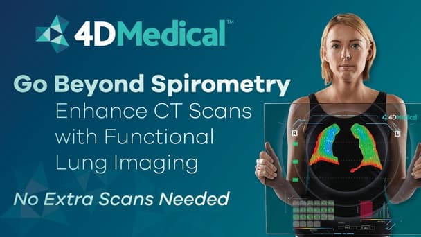 4DMedical banner image